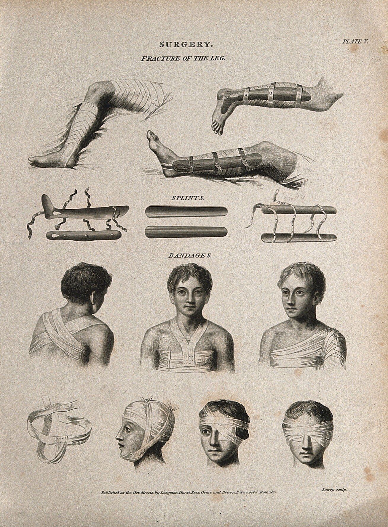 The image shows an old book with a drawing of a man's legs and a woman's head, both of whom have...