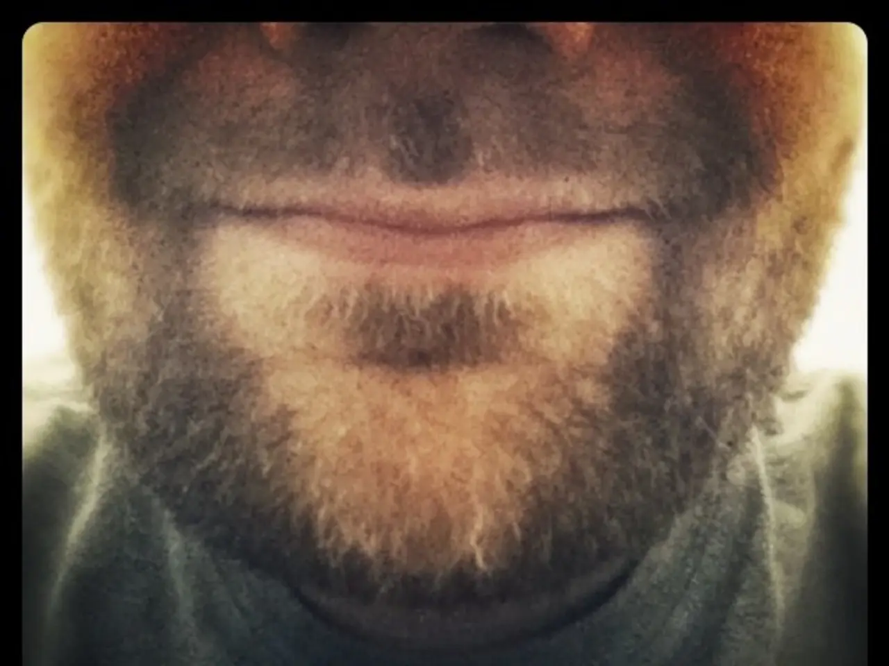 Contemplating a facelift? Here are four crucial facts to consider