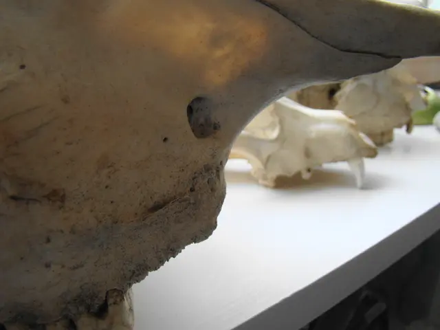 Considers the Essence of Radiation: