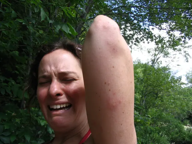 Unhealthy Stress versus the Misconception of a Healthy Stress State?