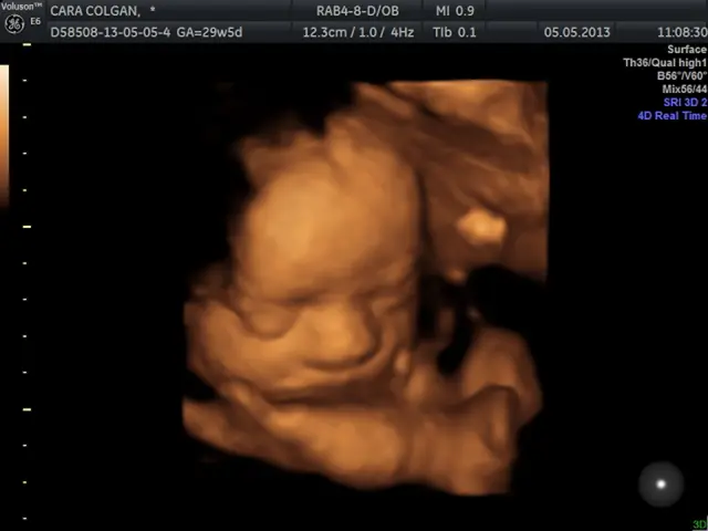 Brain development of the baby accelerates significantly in Week 30