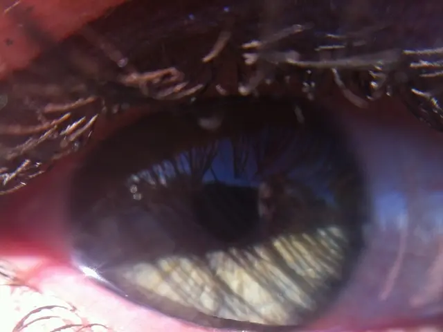 Guide to Reducing Eye Puffiness Caused by Crying