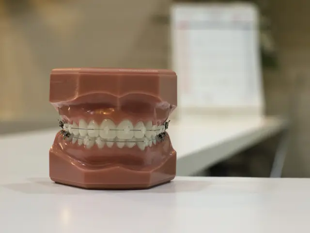 The image shows a model of teeth on a table with braces attached to them. The background is...