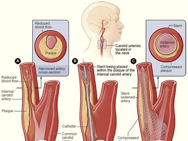 The image shows a diagram of the anatomy of the heart, with a person's head in the center and text...
